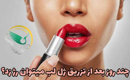 زدن رژ لب بعد از تزریق ژل لب