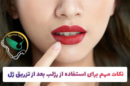 زدن رژ لب بعد از تزریق ژل لب