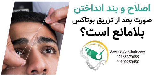 اصلاح و بند انداختن صورت بعد از تزریق بوتاکس بلامانع است؟