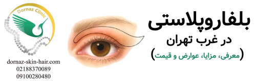 بلفاروپلاستی در غرب تهران (مزایا، معایب، قیمت)
