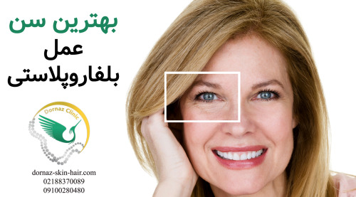بهترین سن عمل بلفاروپلاستی