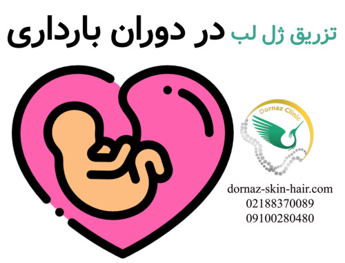 تزریق ژل در دوران بارداری