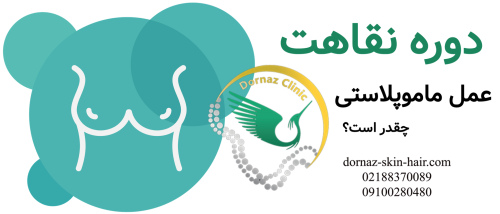 دوره نقاهت ماموپلاستی