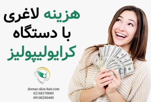 هزینه لاغری با دستگاه کرایولیپولیز