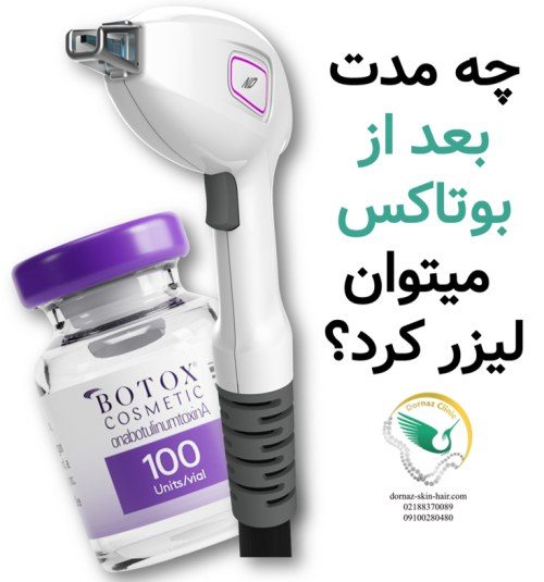 چه مدت بعد از بوتاکس می توان لیزر کرد؟