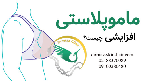 ماموپلاستی افزایشی چیست؟ماموپلاستی کاهشی چیست؟