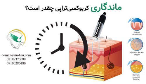 ماندگاری کربوکسی تراپی چقدر است؟