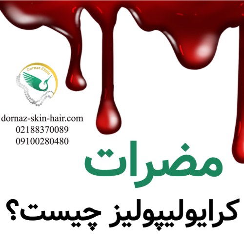 مضرات کرایولیپولیز چیست؟