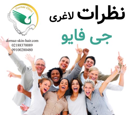 نظرات لاغری با جی فایو