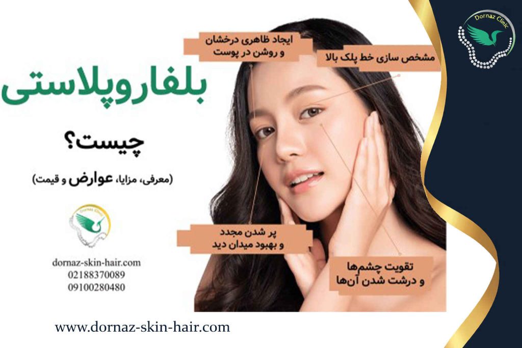بلفاروپلاستی چیست؟