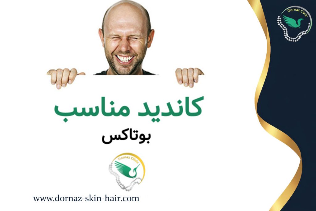 کاندید مناسب بوتاکس کیست؟