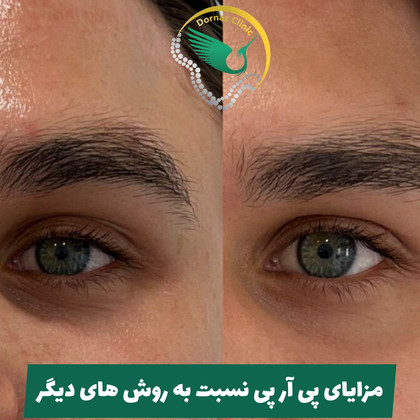 بهترین مرکز پی آر پی در شهرک غرب