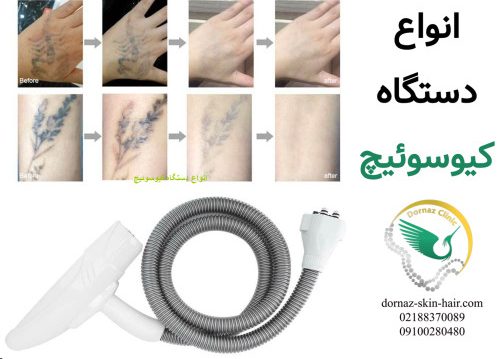 دستگاه کیوسوئیچ چیست؟