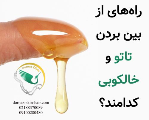 راه های از بین بردن تاتو