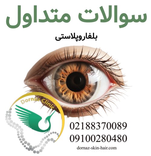 سوالات متداول بلفاروپلاستی