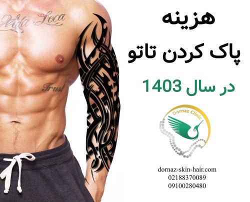 هزینه پاک کردن خالکوبی با لیزر