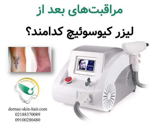 مراقبت های بعد از لیزر کیوسوئیچ چیست؟