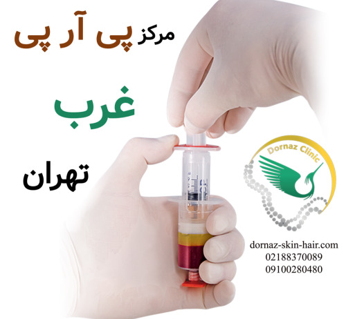 بهترین مرکز پی آر پی غرب تهران