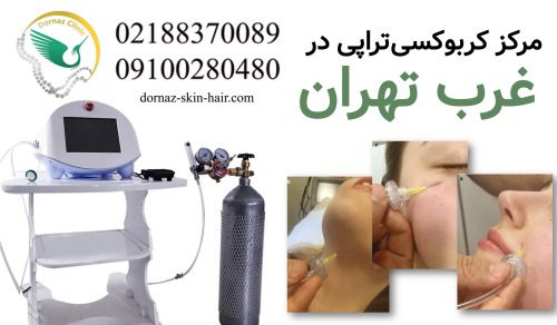 مرکز کربوکسی تراپی در غرب تهران بهترین دکتر کربوکسی تراپی