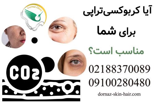 آیا کربوکسی تراپی برای شما مناسب است؟