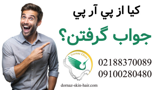 نظرات پی آر پی