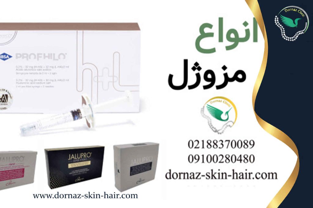 انواع مزوژول