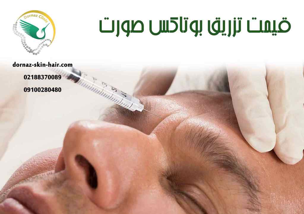 قیمت تزریق بوتاکس