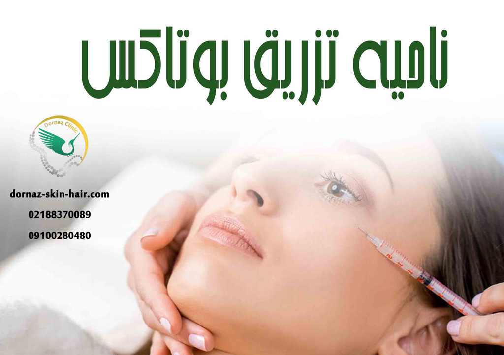 ناحیه تزریق بوتاکس