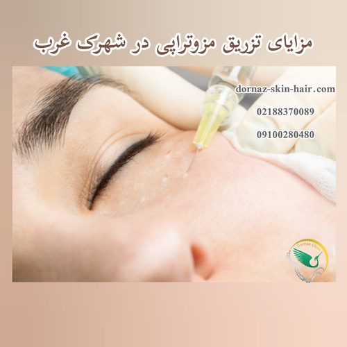 مزایای تزریق مزوتراپی در شهرک غرب