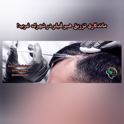 ماندگاری تزریق هیرفیلر در شهرک غرب