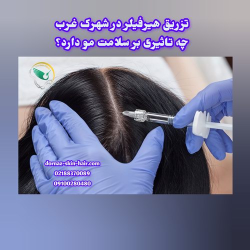 تزریق هیرفیلر در شهرک غرب چه تاثیر بر سلامت مو دارد؟