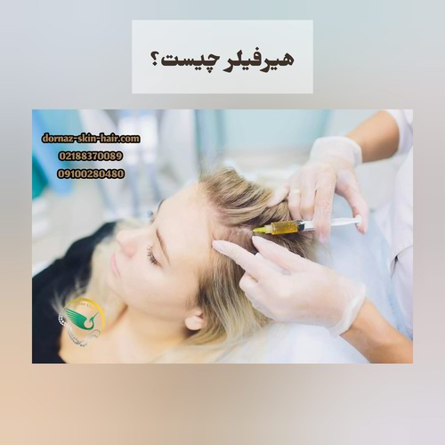 هیرفیلر چیست