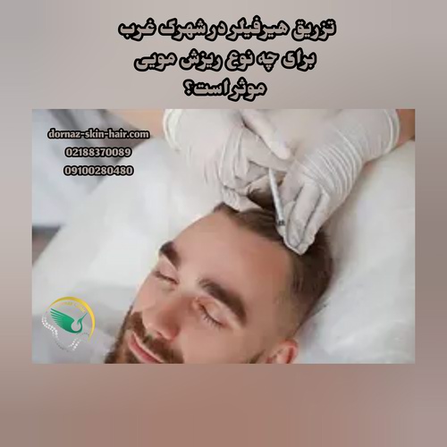 تزریق هیرفیلر برای چه کسانی مناسب است