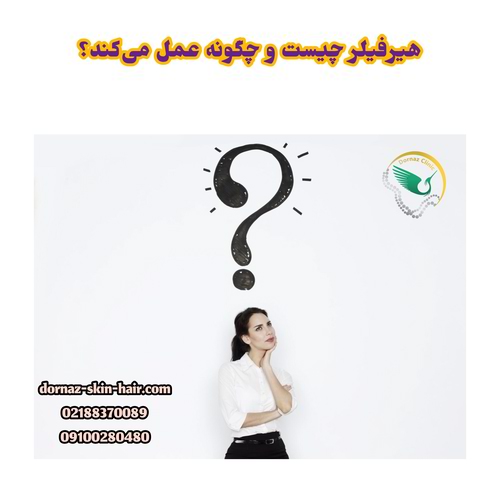 هیرفیلر چیست و چگونه عمل میکند