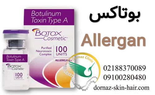 بوتاکس allergan