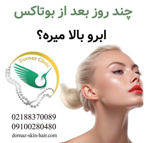 چند روز بعد از بوتاکس ابرو بالا میره؟