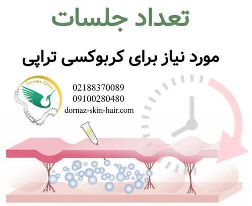 تعداد جلسات مورد نیاز برای کربوکسی تراپی در شهرک غرب 