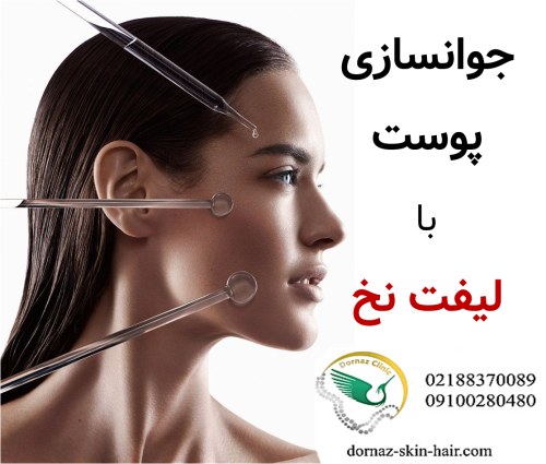 جوان‌سازی پوست با لیفت نخ