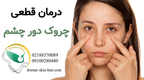 درمان قطعی چروک دور چشم