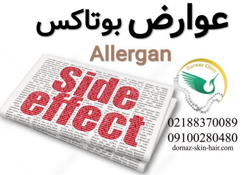 بوتاکس آلرگانعوارض بوتاکس عوارض بوتاکس allergan