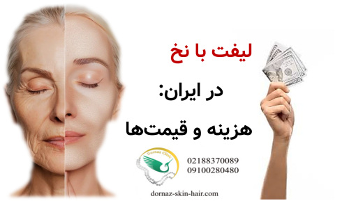 لیفت با نخ در ایران هزینه و قیمت‌ها