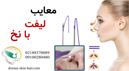 معایب لیفت با نخ