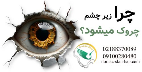 چرا زیر چشم چروک می شود؟