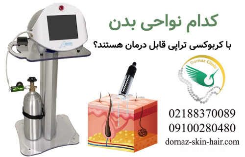نواحی کربوکسی تراپی