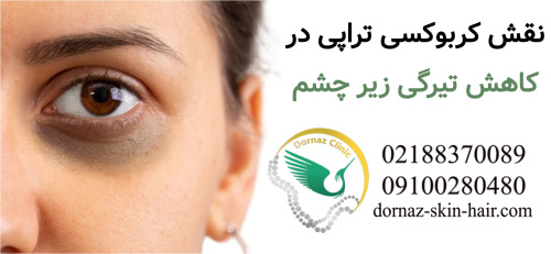 کربوکسی تراپی زیر چشم