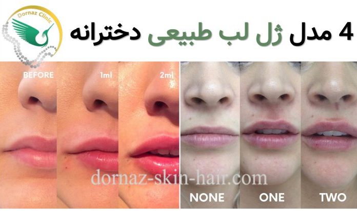 4 مدل ژل طبیعی دخترانه