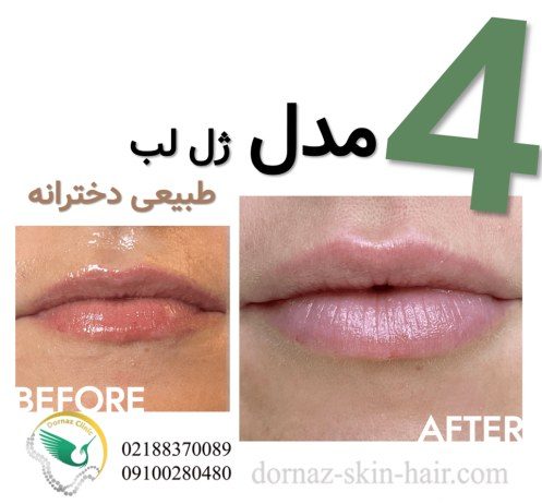 4 مدل ژل لب طبیعی دخترانه انواع ژل لب