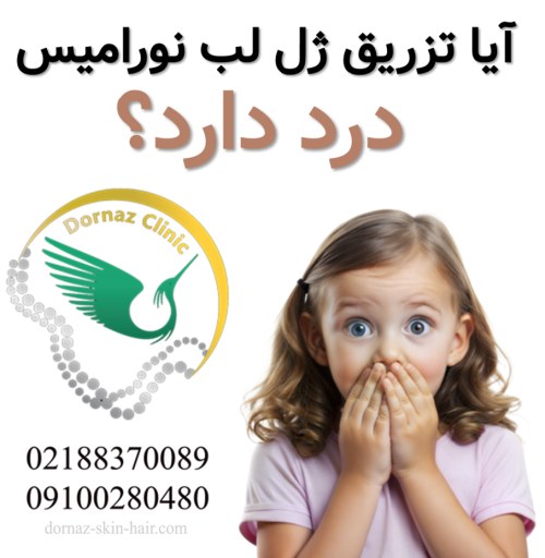 آیا تزریق ژل لب نورامیس درد دارد؟