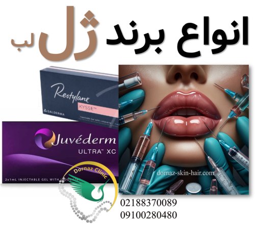 انواع برند ژل لب