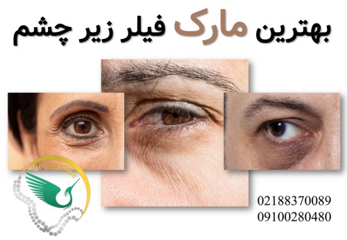 بهترین مارک فیلر زیر چشم